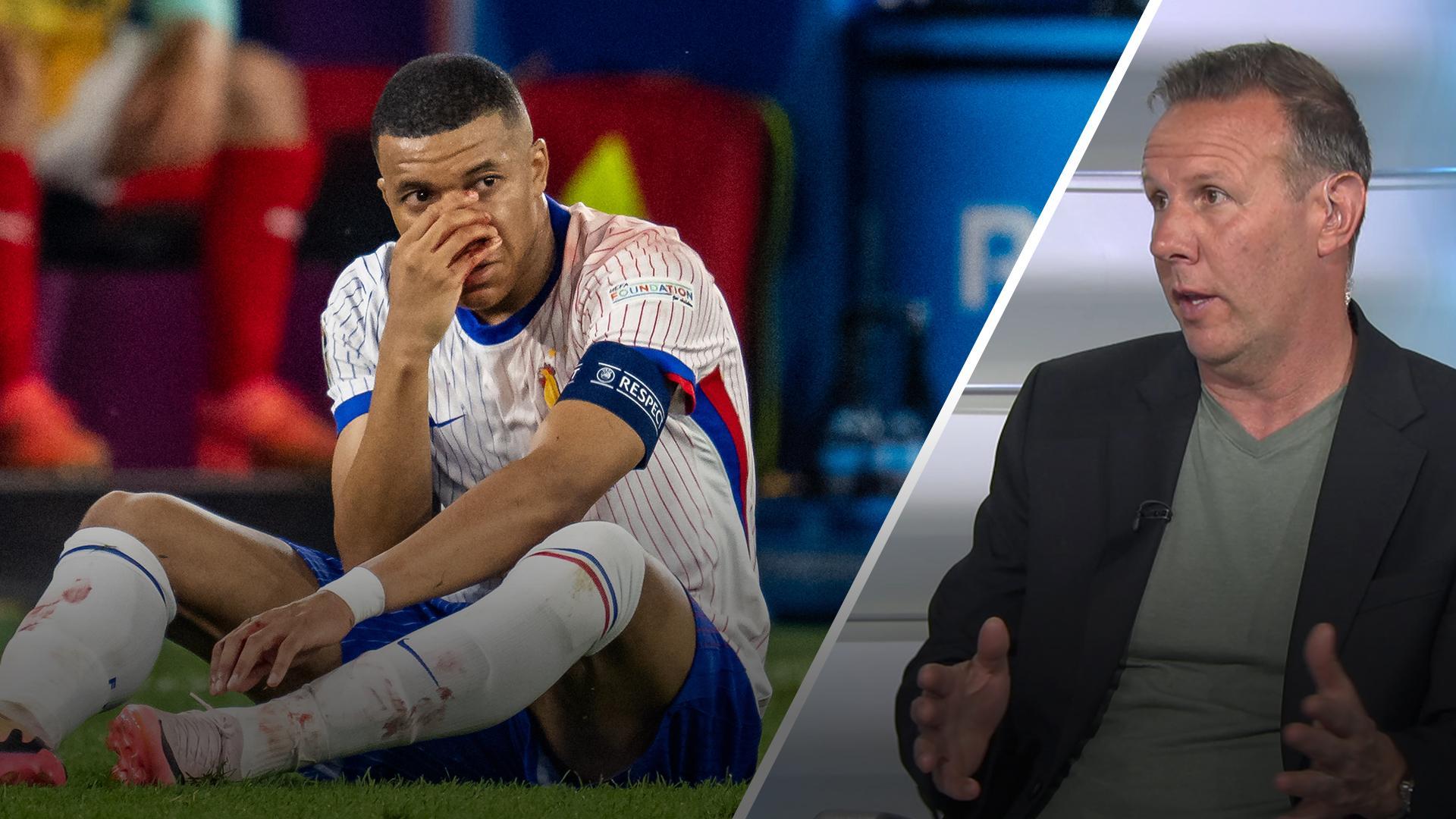 Will Kylian Mbappe's broken nose impact France's Euro 2024 chances?