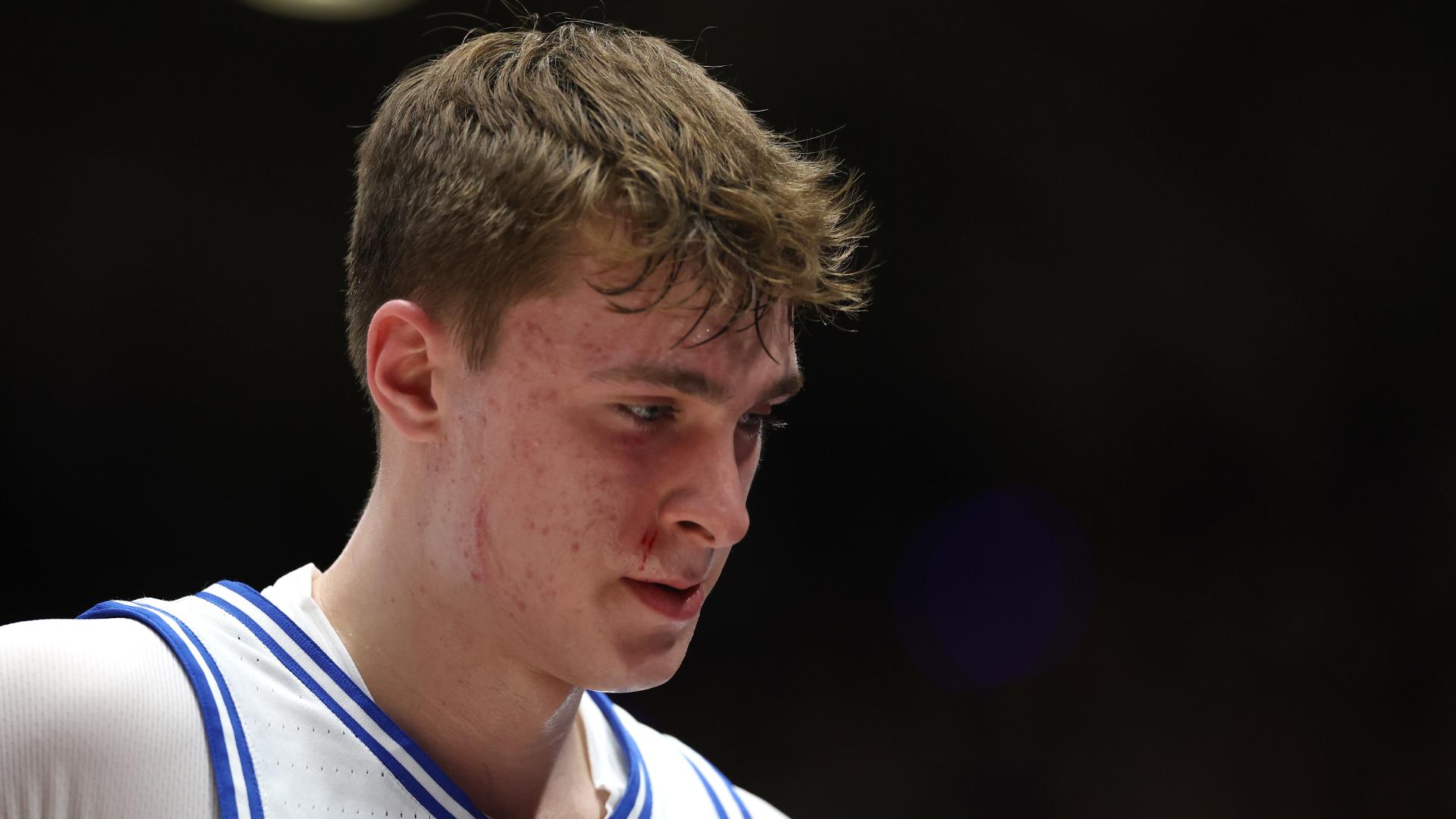 Duke's Cooper Flagg briefly exits game against FSU