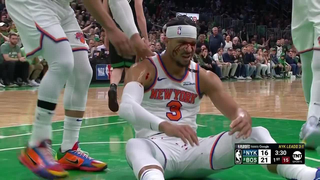 Luke Kornet bloodies Josh Hart with elbow