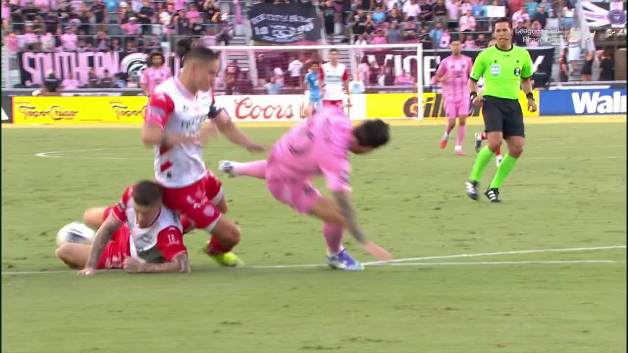 Messi leaves with injury as Inter Miami rally to win in PKs